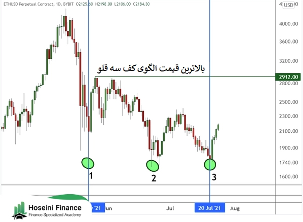 بالاترین قیمت کف سه قلو